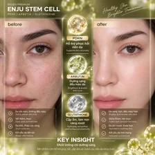 Infographic minh họa trước–sau và ba hoạt chất PDRN – Arbutin – Glutathione của ENJU