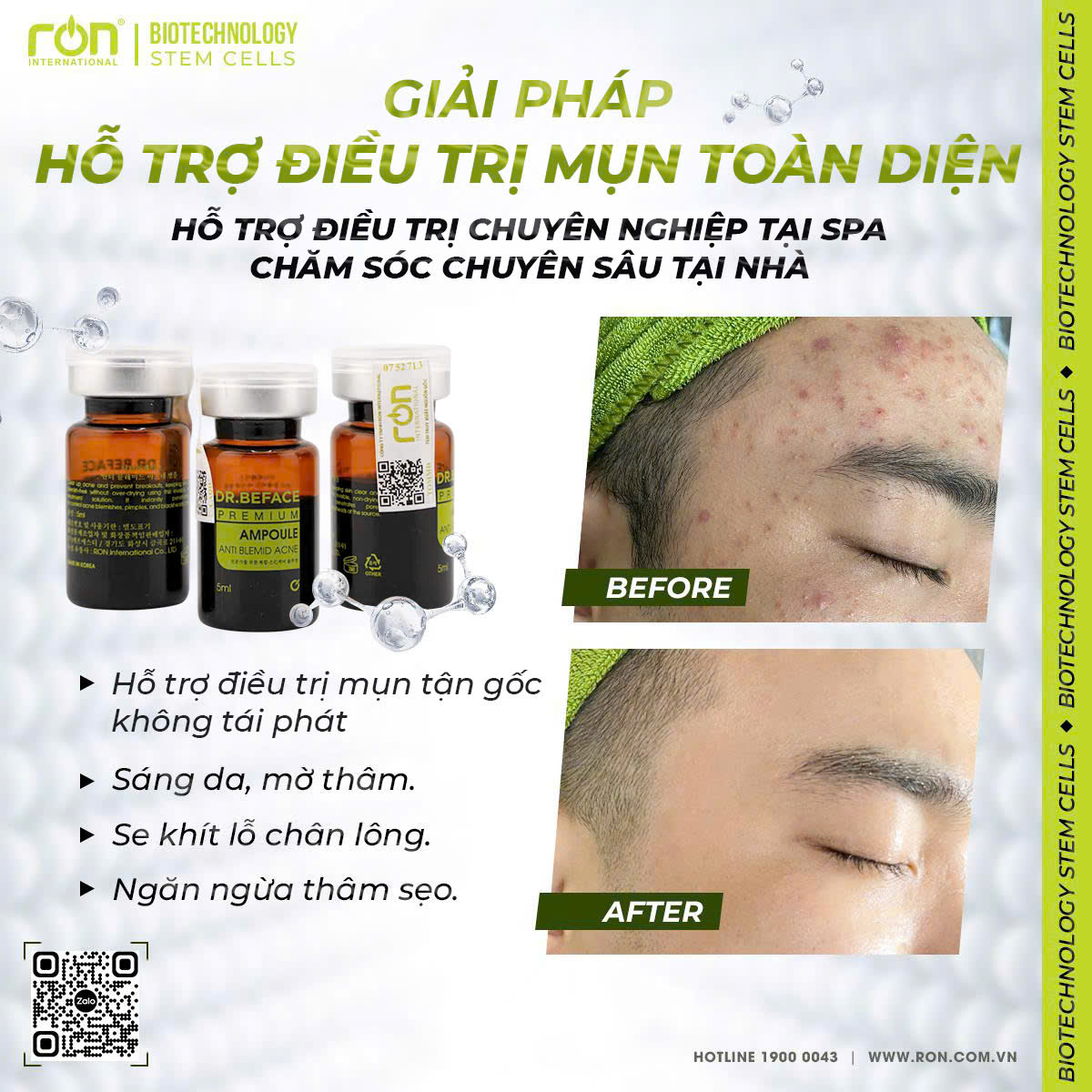 SERUM HỖ TRỢ GIẢM MỤN DR.BEFACE – GIẢI PHÁP CHĂM SÓC DA CHUYÊN NGHIỆP CHO SPA (2)