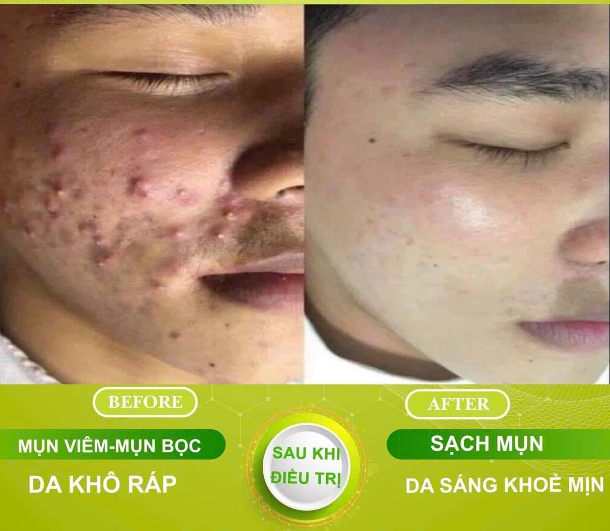 before-after-tri-mun-dr-beface-1