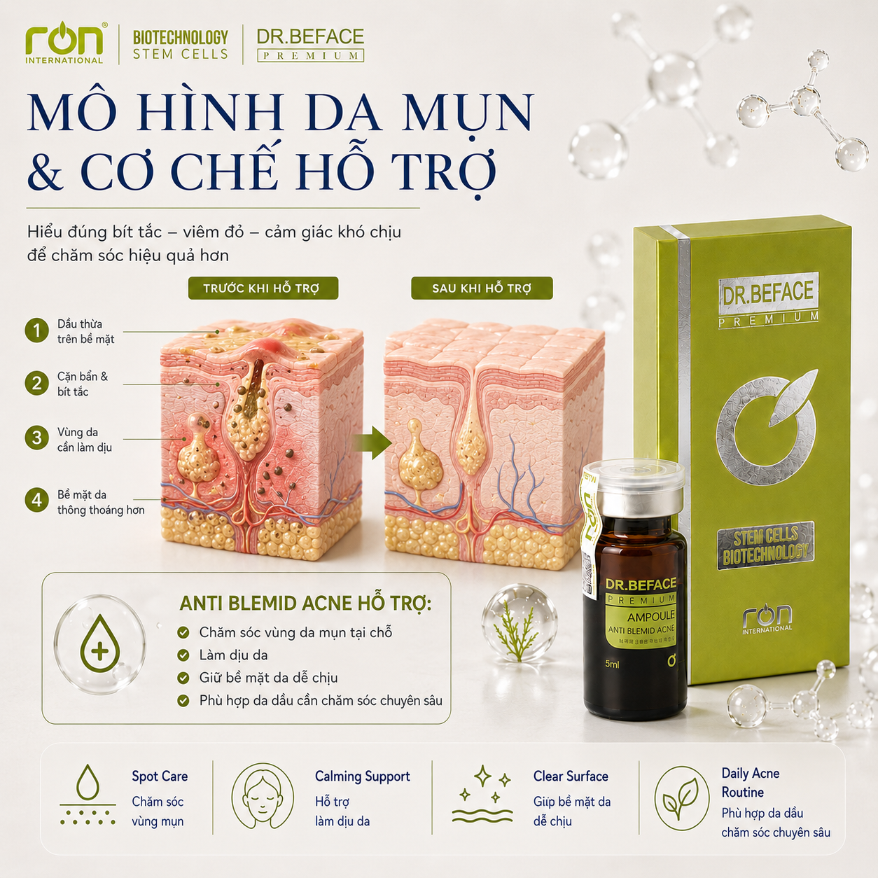 mụn nâu (3)