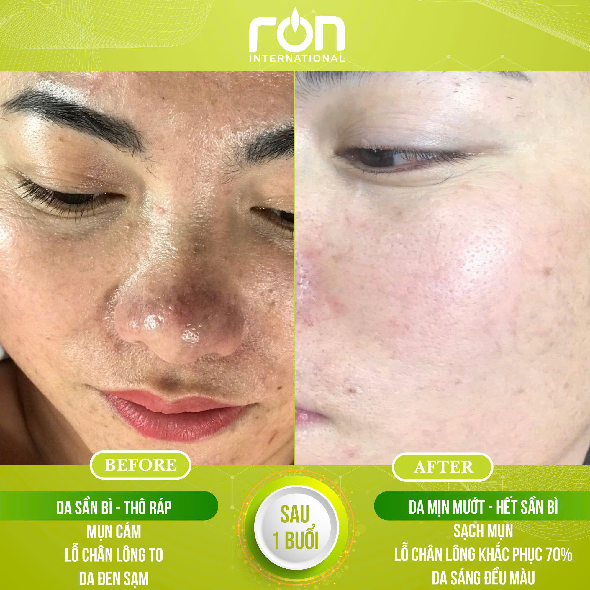 spa-su-dung-serum-dr-beface-1.jpg