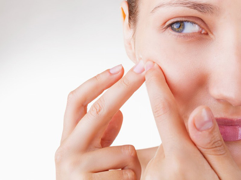 cách trị mụn đầu trắng