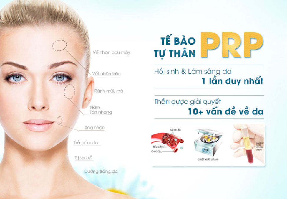 Điều trị sẹo rỗ