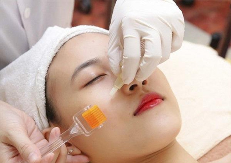 Tế bào gốc dùng sau lăn kim
