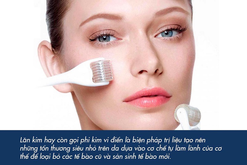Lăn kim tế bào gốc