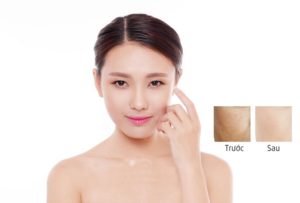 Tế bào gốc