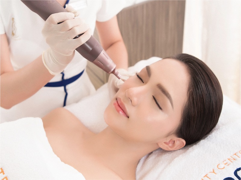 Điều trị sẹo rỗ công nghệ laser