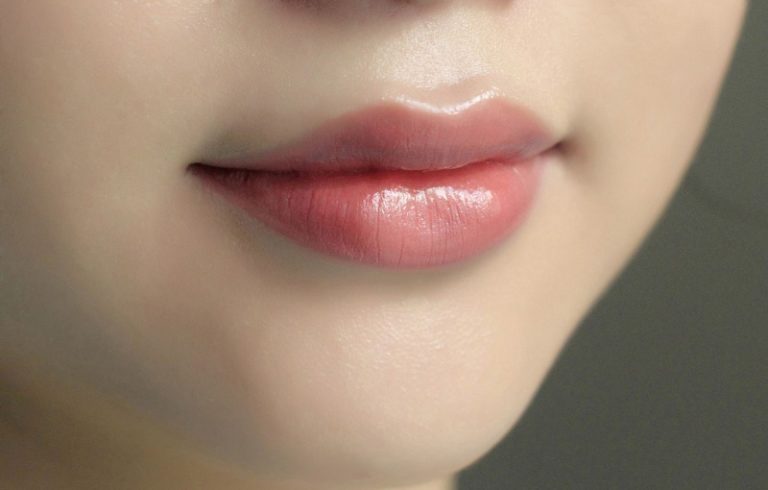 Ảnh minh họa vùng môi; không thể hiện kết quả thủ thuật.