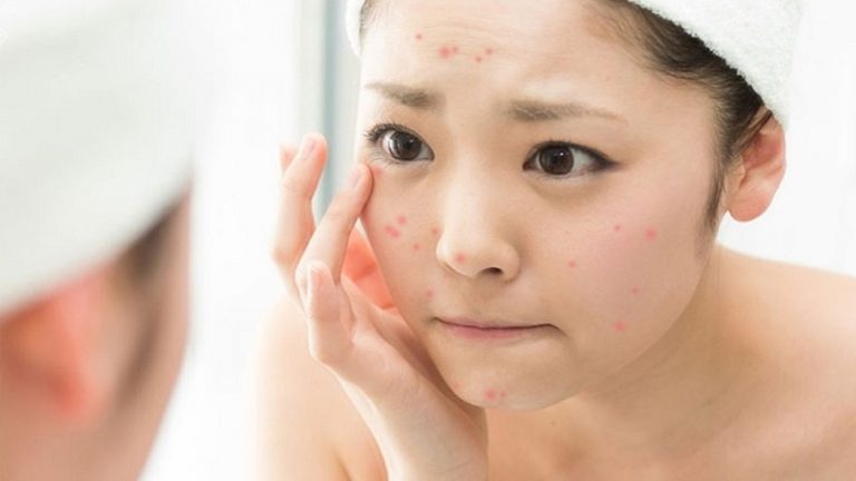 Quan sát vùng da có khuyết điểm.