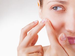 mụn đầu trắng xuất hiện ở mọi lứa tuổi